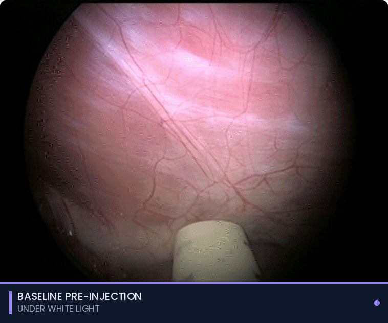 Illuminare-1 fluorescence visualization in the OR